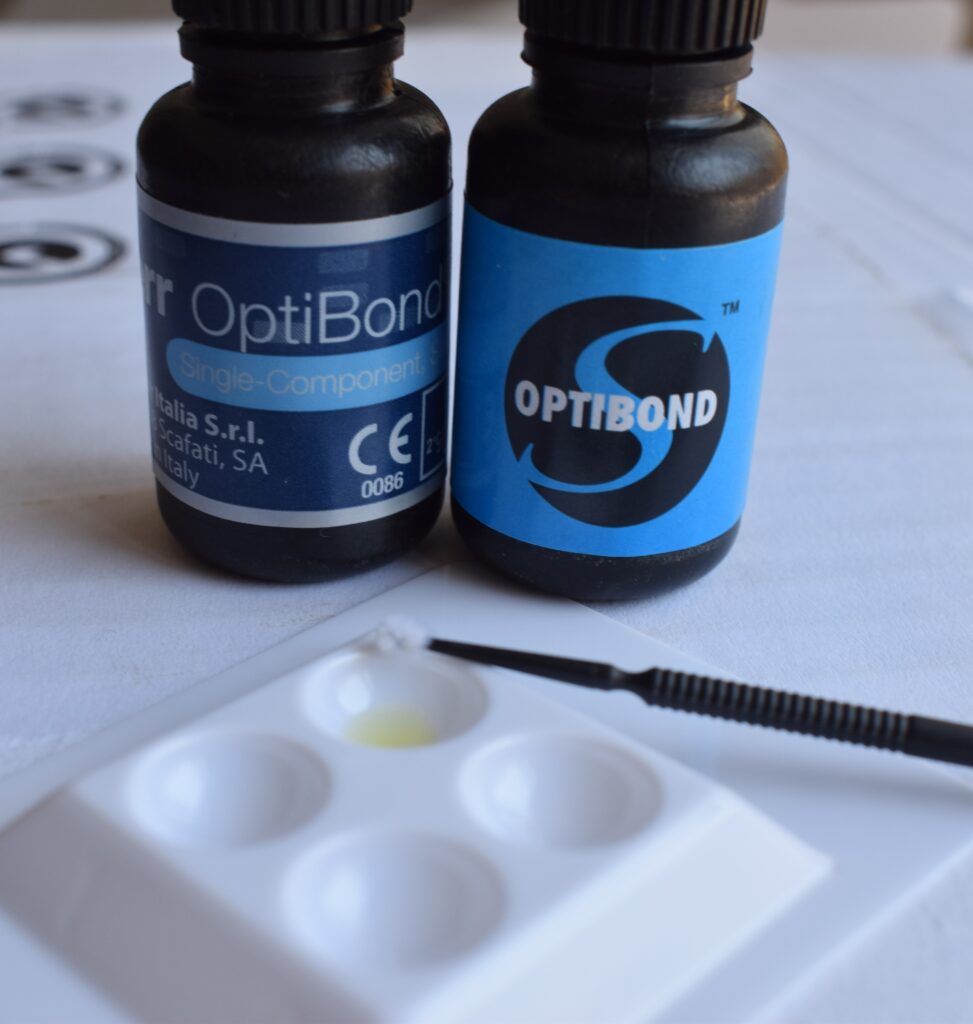 Dental Bonding in Hyderabad: Cost, Types & Procedure Guide