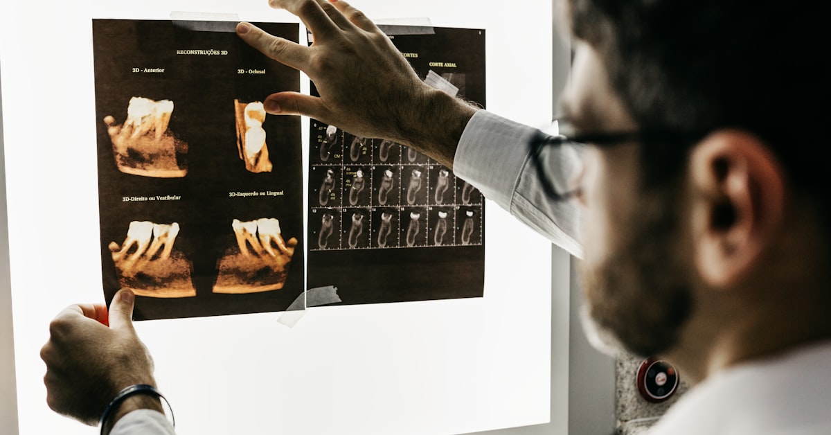 You are currently viewing TMJ Disorder: Warning Signs You Shouldn’t Ignore (And How Dentists Can Help)